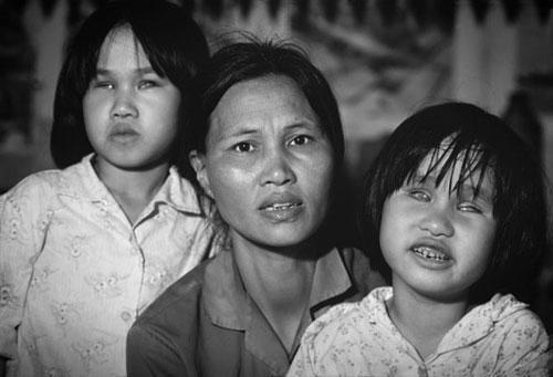 Thông điệp về thảm họa Da cam ở Việt Nam
